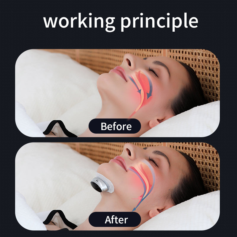 Aura Sleep™ Intelligent Anti-Snore Device